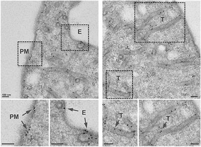 Legionella Effector AnkX Disrupts Host Cell Endocytic Recycling in a Phosphocholination-Dependent Manner